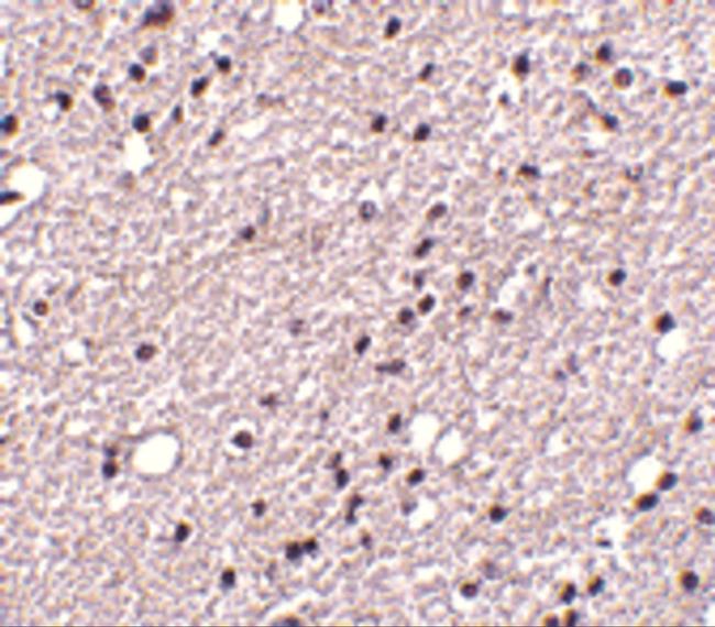 TACR3 Antibody in Immunohistochemistry (IHC)