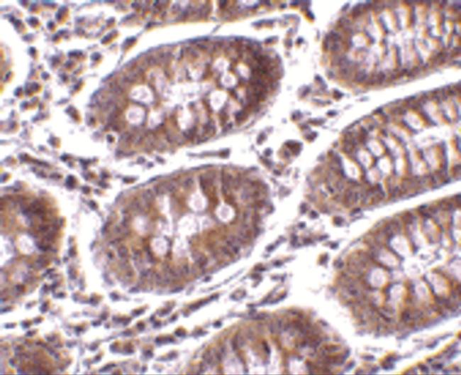 MICA Antibody in Immunohistochemistry (IHC)