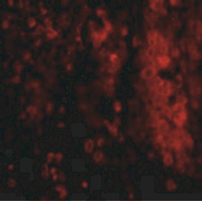 IL-33 Antibody in Immunohistochemistry (IHC)