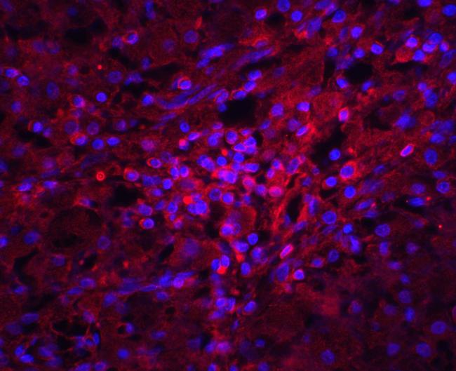 ORAI1 Antibody in Immunohistochemistry (IHC)