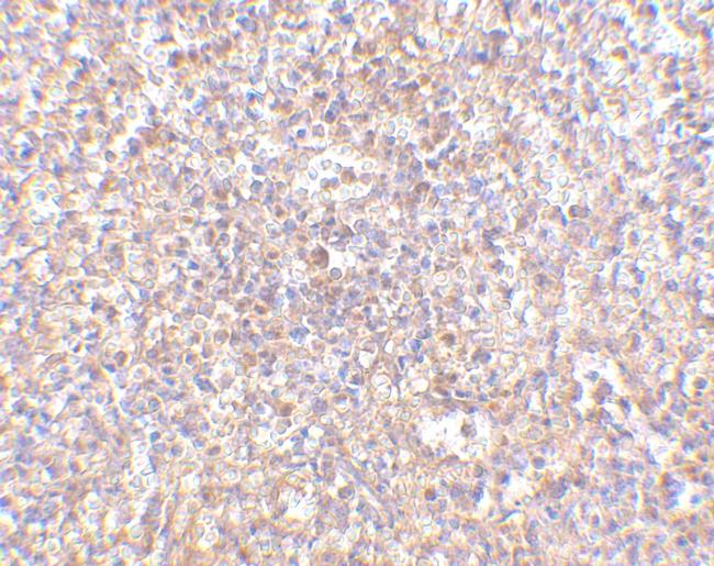 STEAP1 Antibody in Immunohistochemistry (IHC)