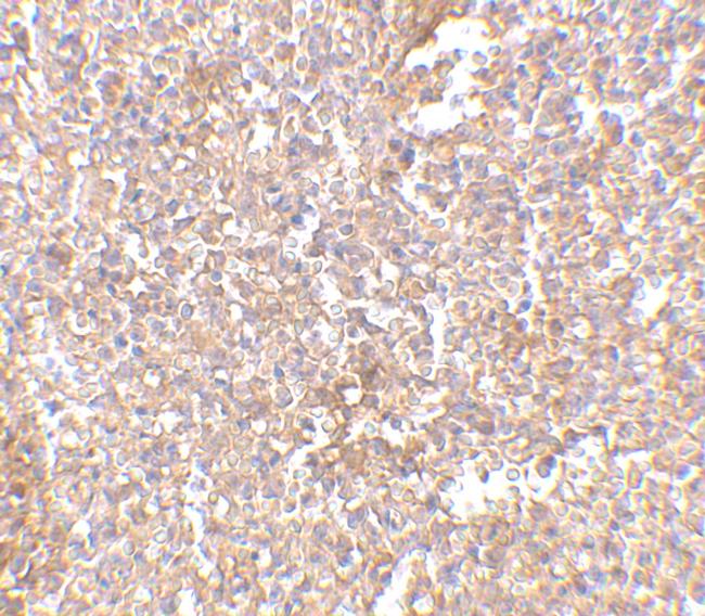 STEAP1 Antibody in Immunohistochemistry (IHC)