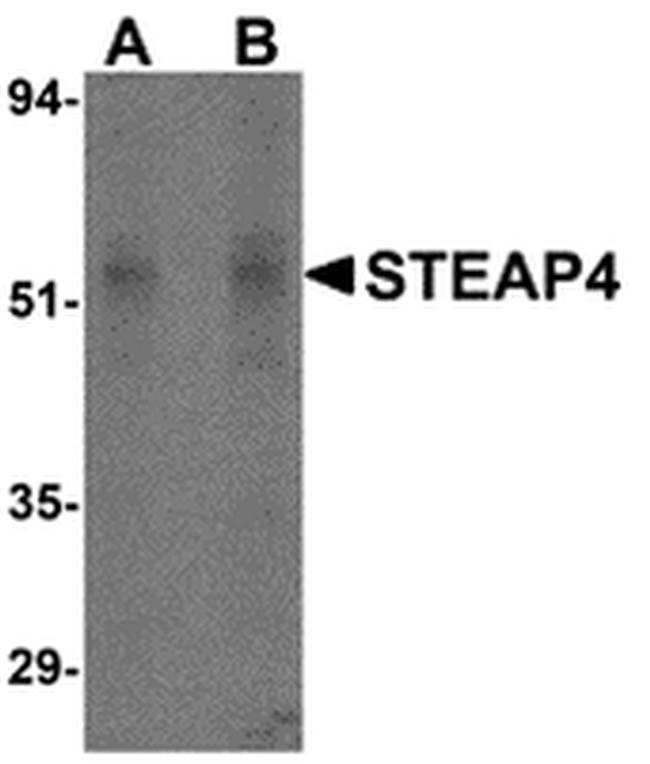 STEAP4 Antibody in Western Blot (WB)