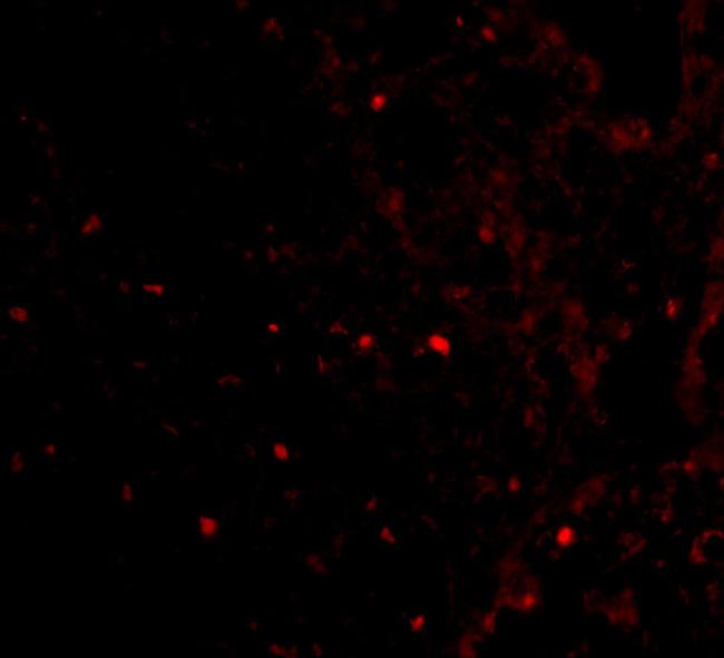 RAP80 Antibody in Immunocytochemistry (ICC/IF)