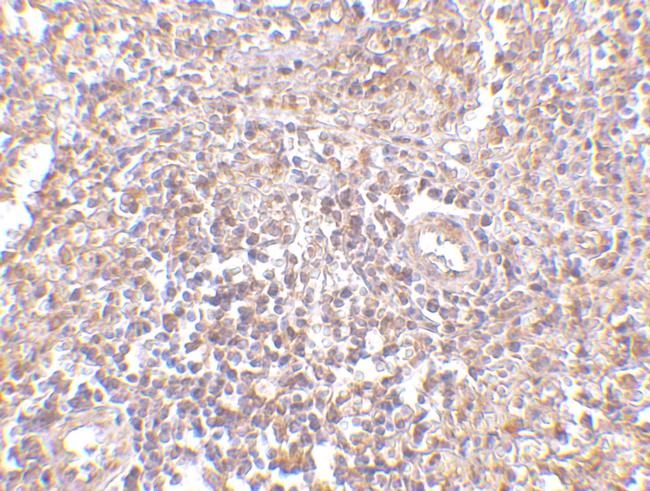 RAP80 Antibody in Immunohistochemistry (IHC)