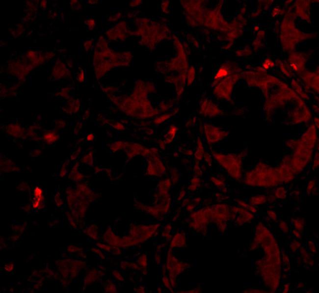 PTK7 Antibody in Immunocytochemistry (ICC/IF)