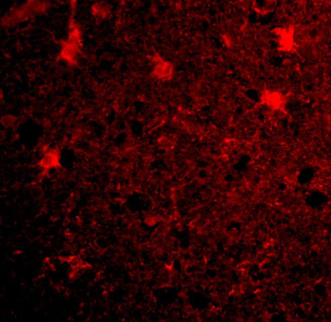 BRCC3 Antibody in Immunocytochemistry (ICC/IF)