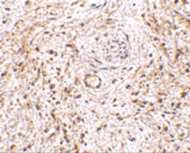 TEM5 Antibody in Immunohistochemistry (IHC)