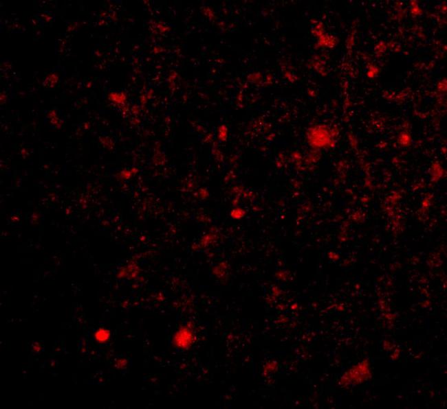 TOCA-1 Antibody in Immunocytochemistry (ICC/IF)