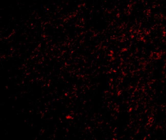 TOCA-1 Antibody in Immunocytochemistry (ICC/IF)