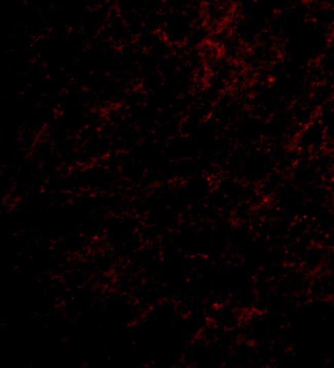 Nhe-1 Antibody in Immunocytochemistry (ICC/IF)