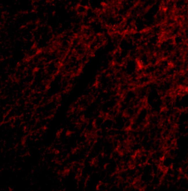 GRIK1 Antibody in Immunocytochemistry (ICC/IF)