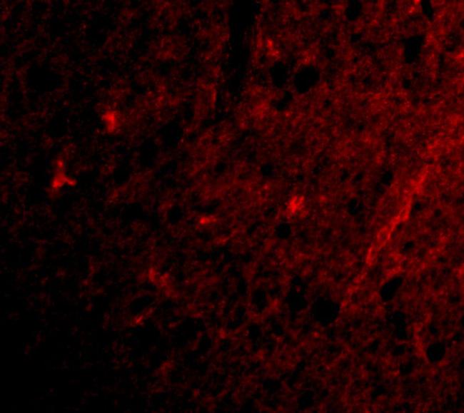 GRIK1 Antibody in Immunocytochemistry (ICC/IF)