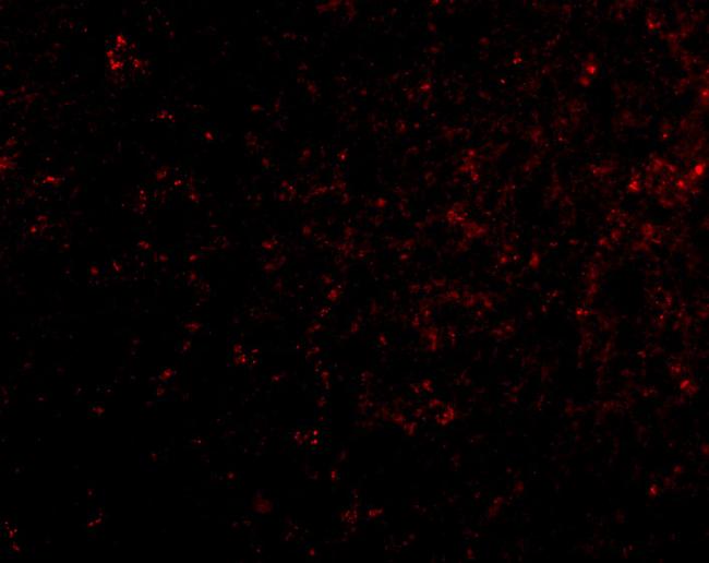 GRIK4 Antibody in Immunocytochemistry (ICC/IF)