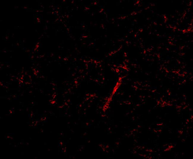 GRIK4 Antibody in Immunocytochemistry (ICC/IF)