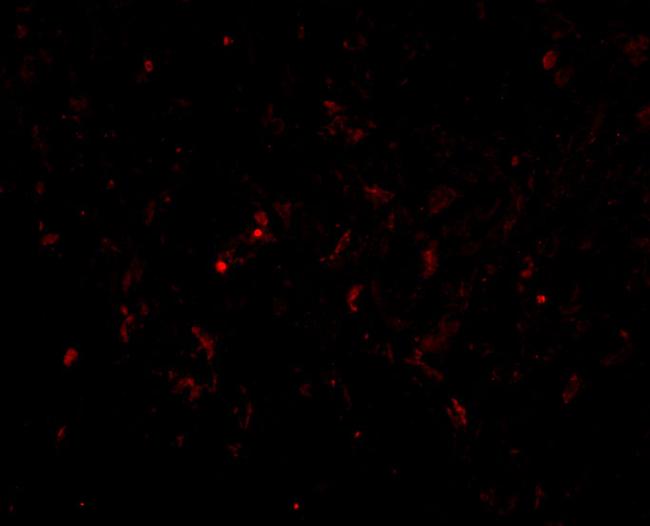 GSTP1 Antibody in Immunocytochemistry (ICC/IF)