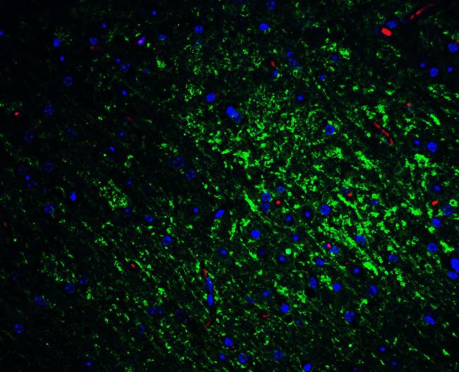 SLITRK1 Antibody in Immunohistochemistry (IHC)