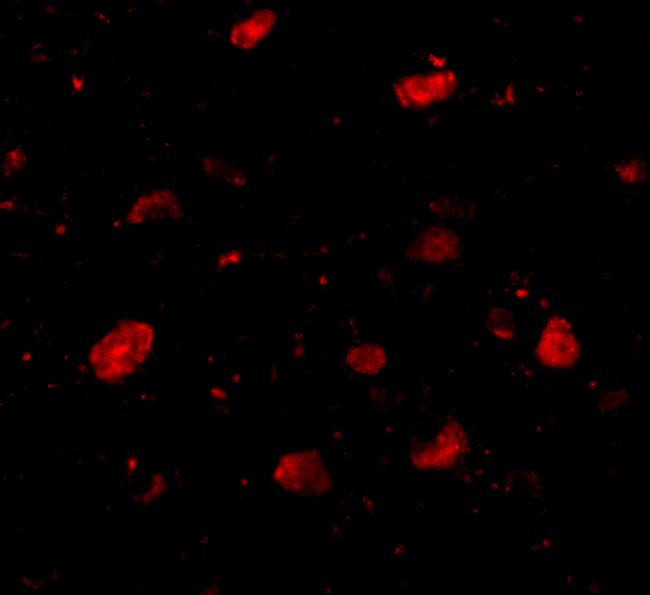 SLITRK5 Antibody in Immunocytochemistry (ICC/IF)