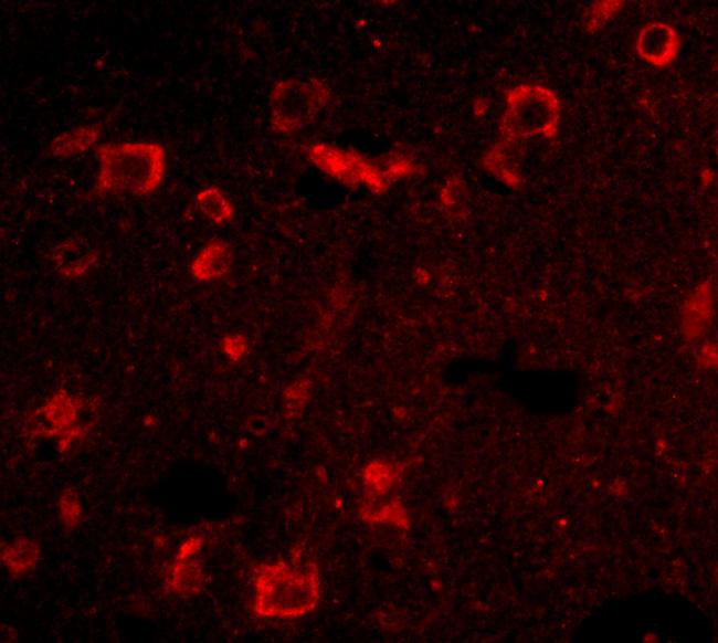 SLITRK6 Antibody in Immunocytochemistry (ICC/IF)