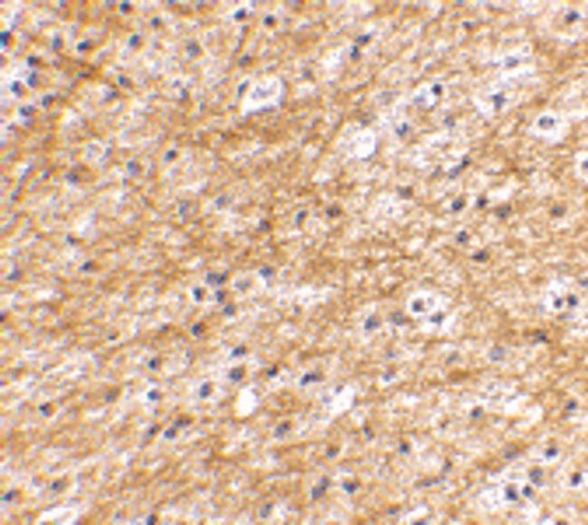 AIFM3 Antibody in Immunohistochemistry (IHC)