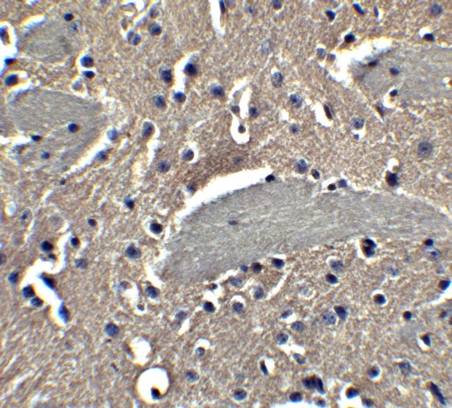 NPTX2 Antibody in Immunohistochemistry (Paraffin) (IHC (P))