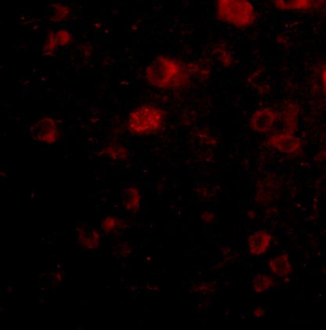 VGF Antibody in Immunocytochemistry (ICC/IF)