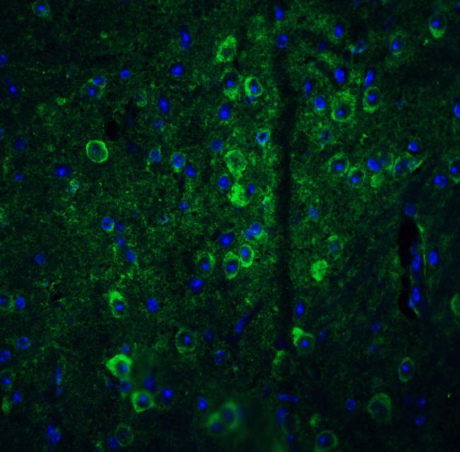 GPAM Antibody in Immunohistochemistry (IHC)