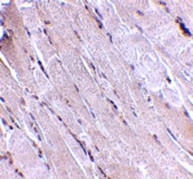 WNT10B Antibody in Immunohistochemistry (IHC)