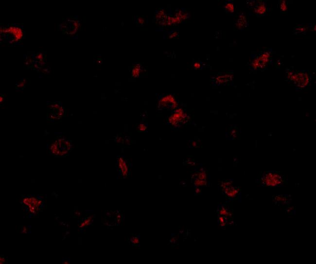 SAPAP1 Antibody in Immunocytochemistry (ICC/IF)