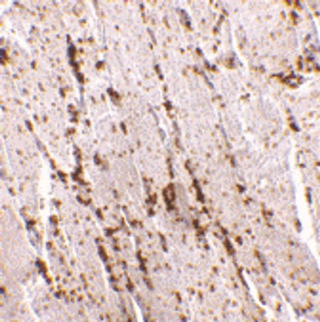 LIMP2 Antibody in Immunohistochemistry (IHC)