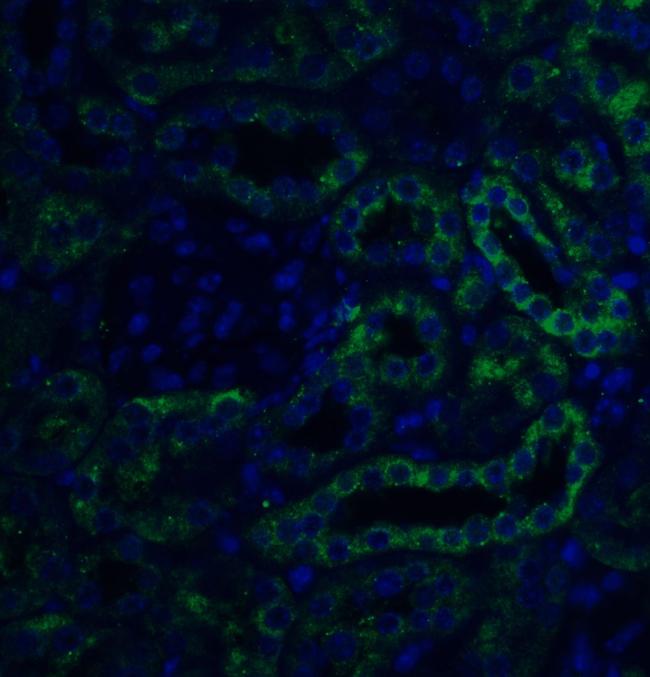 SLC22A17 Antibody in Immunohistochemistry (IHC)