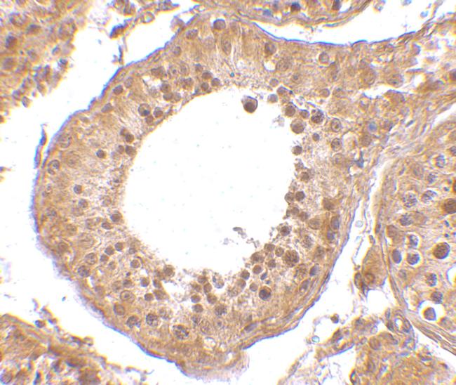 RGPD5 Antibody in Immunohistochemistry (IHC)