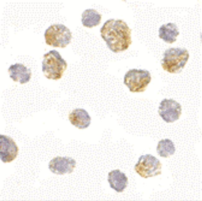 SLC35D1 Antibody in Immunocytochemistry (ICC/IF)