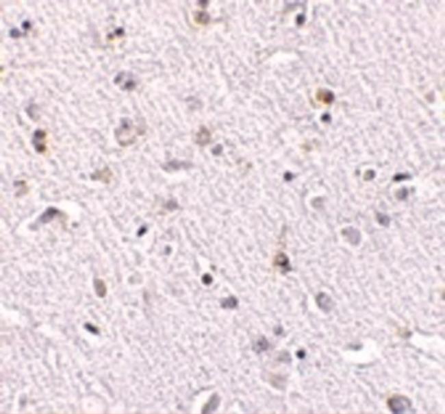 NANOS1 Antibody in Immunohistochemistry (IHC)