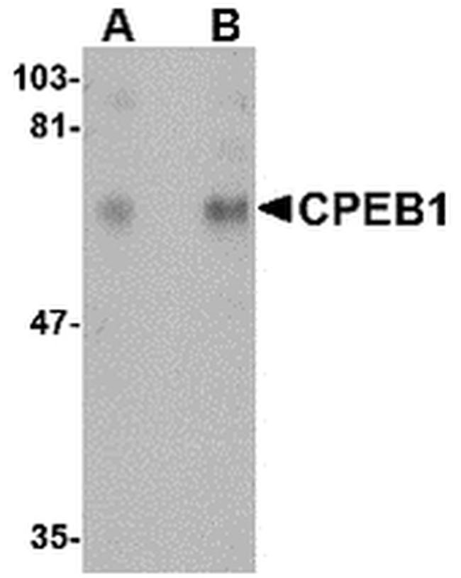 CPEB1 Antibody in Western Blot (WB)