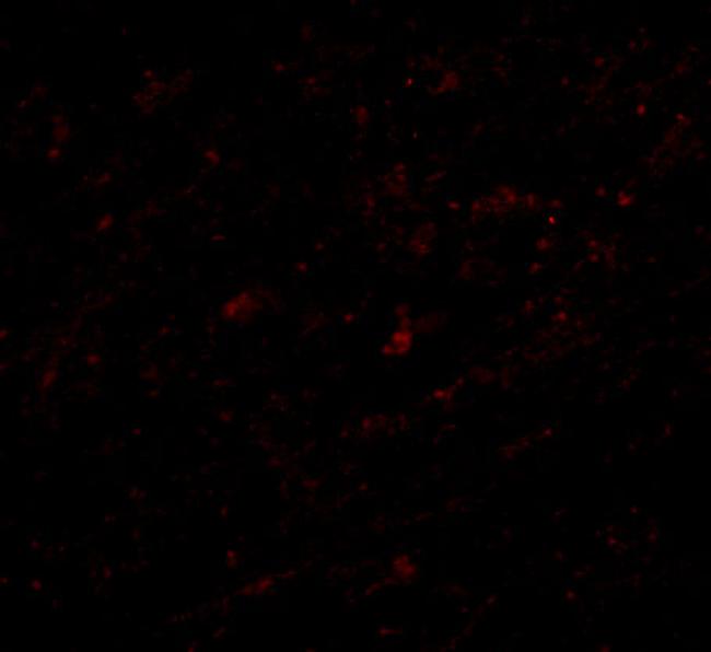 Lass5 Antibody in Immunocytochemistry (ICC/IF)