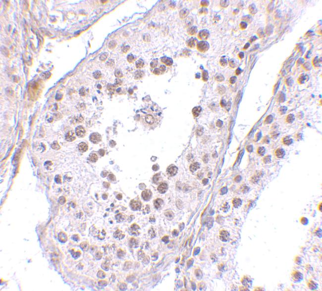 MED4 Antibody in Immunohistochemistry (IHC)