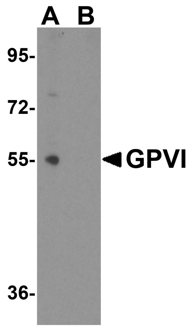 GP6 Antibody in Western Blot (WB)