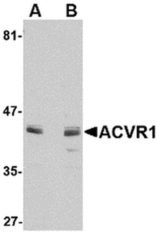 ACVR1 Antibody in Western Blot (WB)