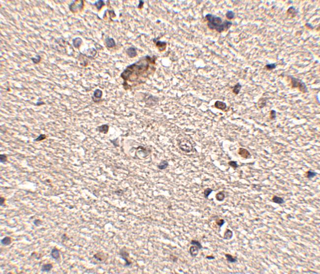 SPRED1 Antibody in Immunohistochemistry (IHC)