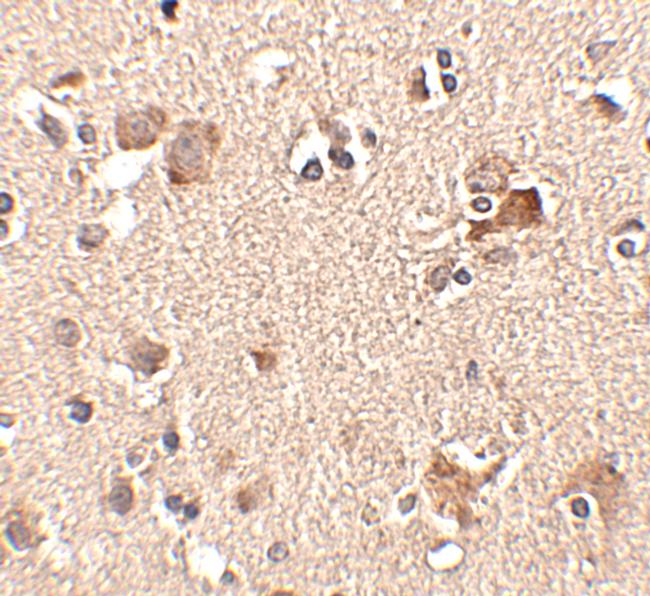 AIPL1 Antibody in Immunohistochemistry (IHC)