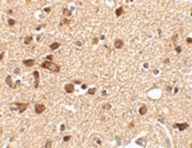 STK39 Antibody in Immunohistochemistry (IHC)