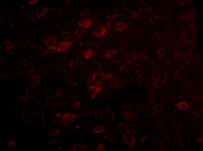 Lass6 Antibody in Immunocytochemistry (ICC/IF)