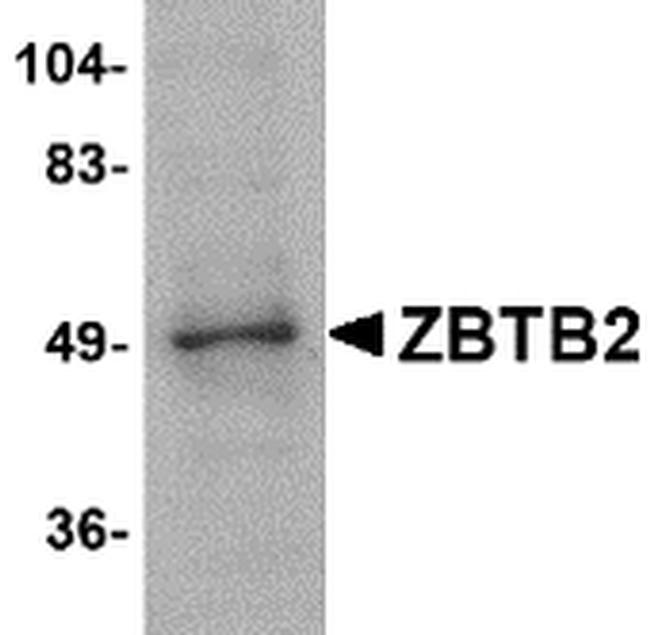 ZBTB2 Antibody in Western Blot (WB)