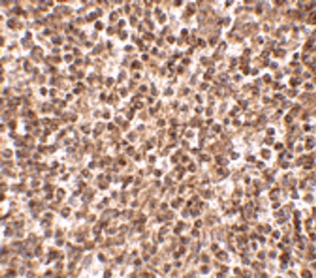 TREX1 Antibody in Immunohistochemistry (IHC)