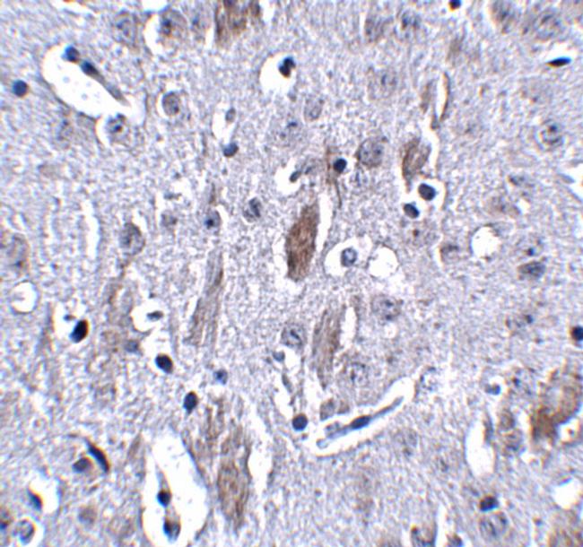 IL-16 Antibody in Immunohistochemistry (Paraffin) (IHC (P))