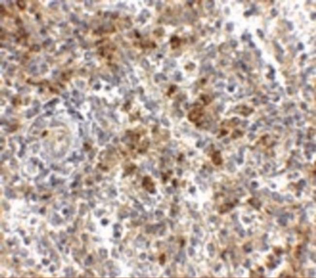 OCC1 Antibody in Immunohistochemistry (IHC)