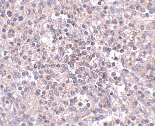 ZIP10 Antibody in Immunohistochemistry (IHC)