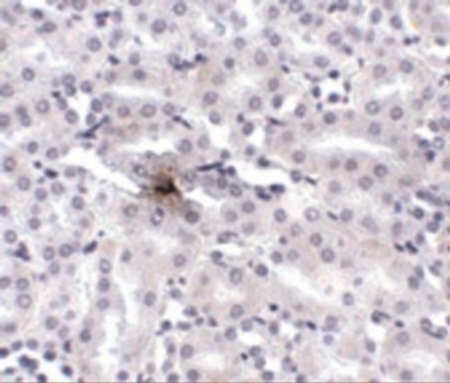 ZIP11 Antibody in Immunohistochemistry (IHC)