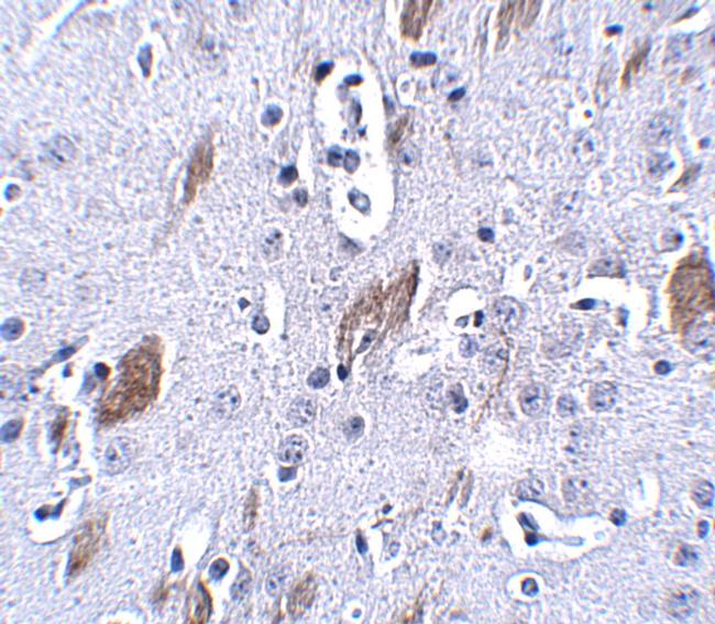 ATOH8 Antibody in Immunohistochemistry (IHC)